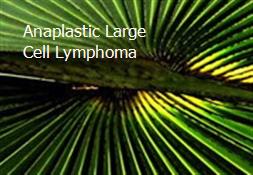 Anaplastic Large Cell Lymphoma Powerpoint Presentation