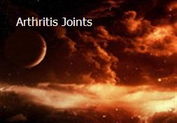 Arthritis Joints Powerpoint Presentation