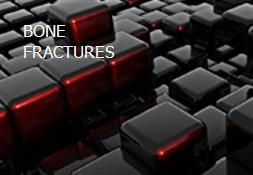 BONE FRACTURES Powerpoint Presentation