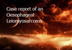 Case report of an Oesophageal Leiomyosarcoma Powerpoint Presentation