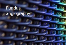 Fundus angiography Powerpoint Presentation