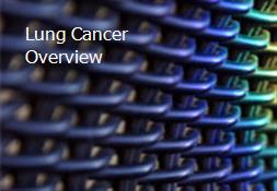 Lung Cancer Overview Powerpoint Presentation