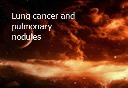 Lung cancer and pulmonary nodules Powerpoint Presentation
