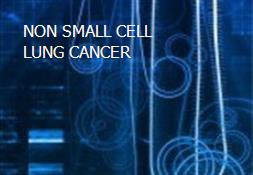 NON SMALL CELL LUNG CANCER Powerpoint Presentation