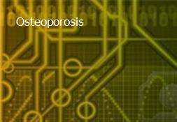 Osteoporosis Powerpoint Presentation
