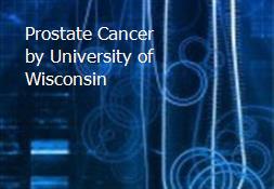 Prostate Cancer by University of Wisconsin Powerpoint Presentation