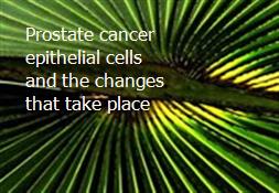 Prostate cancer epithelial cells and the changes that take place Powerpoint Presentation