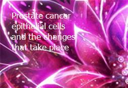 Prostate cancer epithelial cells and the changes that take place Powerpoint Presentation