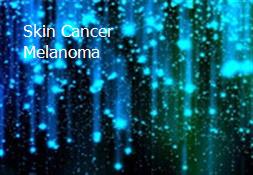 Skin Cancer Melanoma Powerpoint Presentation