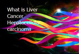 What is Liver Cancer Hepatocellular carcinoma Powerpoint Presentation