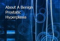About A Benign Prostatic Hyperplasia Powerpoint Presentation