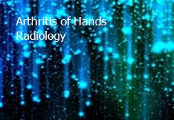 Arthritis of Hands Radiology Powerpoint Presentation