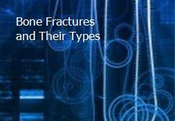 Bone Fractures and Their Types Powerpoint Presentation