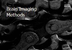 Brain Imaging Methods Powerpoint Presentation
