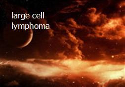 large cell lymphoma Powerpoint Presentation