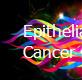 Epithelial Ovarian Cancer Powerpoint Presentation