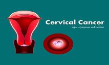 Cervical Cancer Symptoms,Types and Prevention PowerPoint Presentation