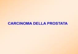 Screening for Prostate Cancer PowerPoint Presentation
