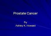 Prostate Cancer by Department of Radiology Powerpoint Presentation
