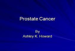 Prostate Cancer by Department of Radiology PowerPoint Presentation