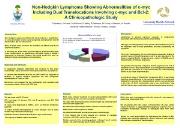 Non Hodgkin Lymphoma Showing Abnormalities of c myc Including Powerpoint Presentation