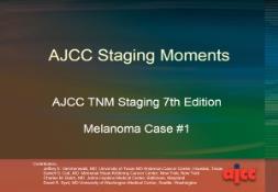 Staging Moments Melanoma PowerPoint Presentation