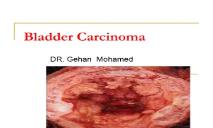 About Bladder Cancer PowerPoint Presentation