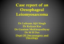 Case report of an Oesophageal Leiomyosarcoma PowerPoint Presentation
