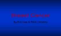 About Women Breast Cancer PowerPoint Presentation