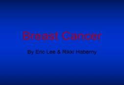 About Women Breast Cancer PowerPoint Presentation