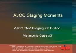 Staging Moments Melanoma Case 3 PowerPoint Presentation