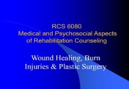 Burn Injury PowerPoint Presentation