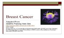 Female Breast Cancer PowerPoint Presentation