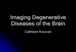Imaging Degenerative Diseases of the Brain PowerPoint Presentation