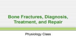 Bone Fractures Diagnosis Treatment and Repair PowerPoint Presentation