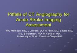 Pitfall of CT Angiography for Acute Stroke Imaging PowerPoint Presentation