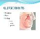 About Allergic Rhinitis Powerpoint Presentation