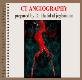 About CT ANGIOGRAPHY Powerpoint Presentation