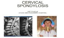 CERVICAL SPONDYLOSIS PowerPoint Presentation