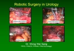 Robotic Urological Surgery PowerPoint Presentation