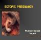AN ECTOPIC PREGNANCY Powerpoint Presentation