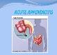 About ACUTE APPENDICITIS Powerpoint Presentation