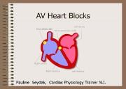 ECG (Heart Blocks) Powerpoint Presentation