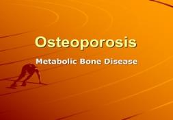 Osteoporosis Osteomalacia Paget Disease PowerPoint Presentation