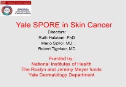 SPORE in Skin Cancer Research PowerPoint Presentation
