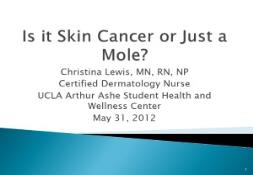 Is it Skin Cancer or Just a Mole PowerPoint Presentation