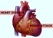 Heart Disease and Heart Attack Powerpoint Presentation