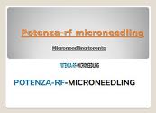 Microneedling platelet rich plasma Powerpoint Presentation