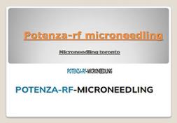 Microneedling platelet rich plasma Powerpoint Presentation