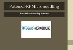 Rf Microneedling Before And After Powerpoint Presentation